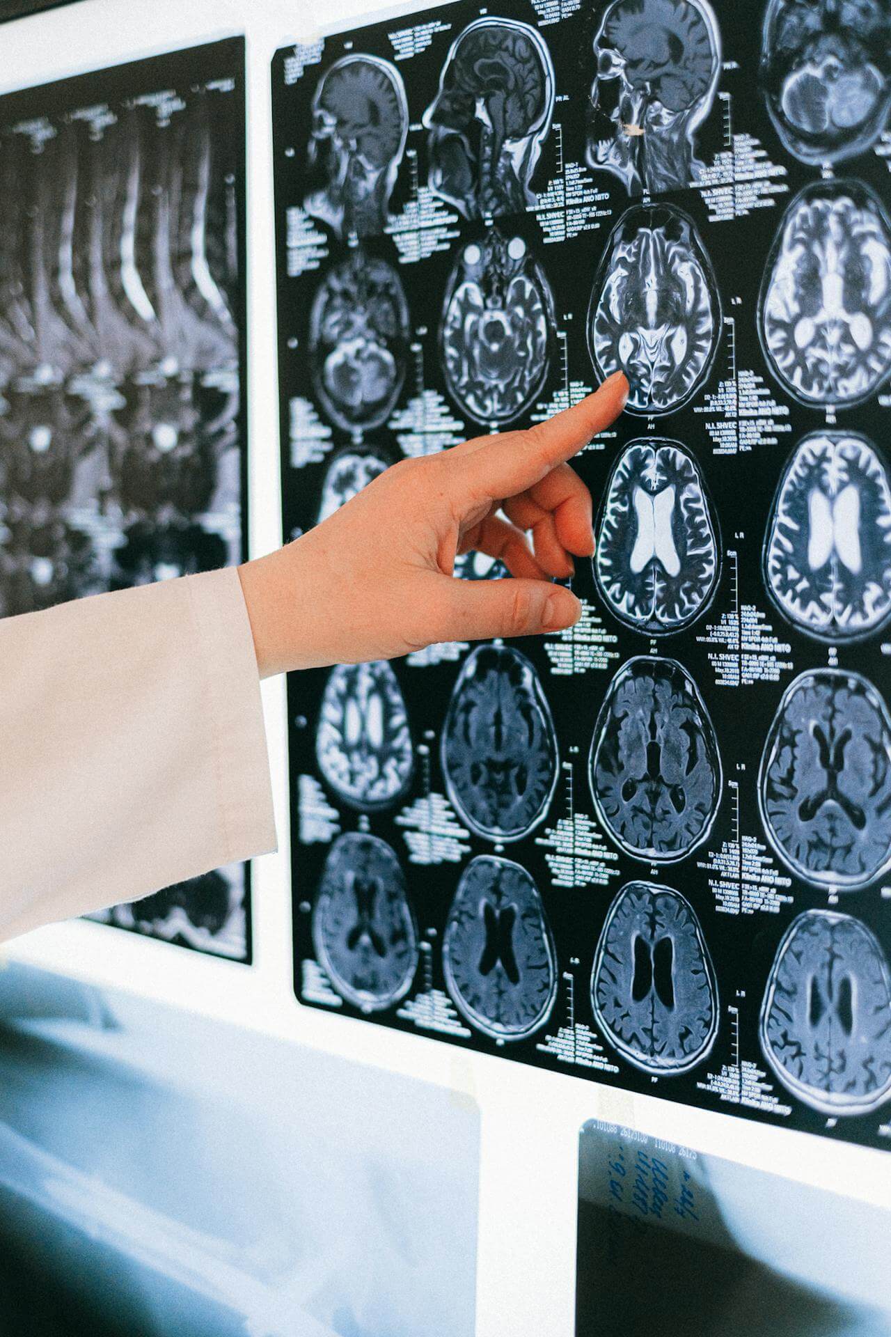 Counselling - Our Brains Have Plasticity